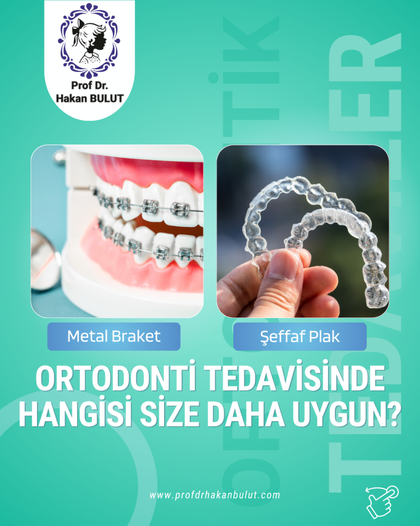 Şeffaf Plak mı Diş Teli mi? İzmir Ortodonti Karşılaştırması